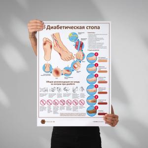 Фото - Диабетическая стопа (плакат А1)