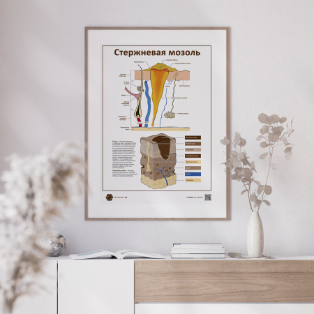 Фото -  Стержневая мозоль версия 2 (плакат А3)