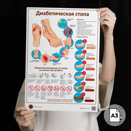 Фото - Диабетическая стопа (плакат А3)