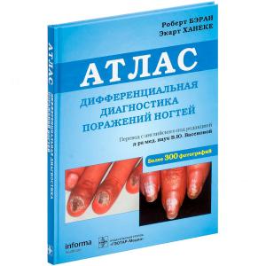 Фото - Дифференциальная диагностика поражений ногтей. Атлас