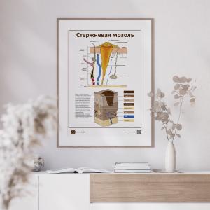 Фото -  Стержневая мозоль версия 2 (плакат А3)
